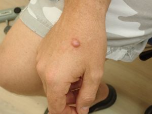 case discussion