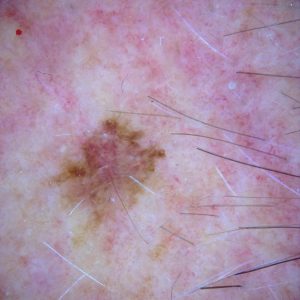 case discussion