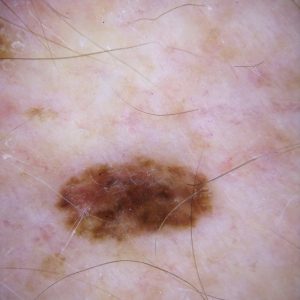 case discussion