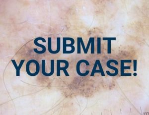 Submit-your-case-259-×-200-px-300x232-2