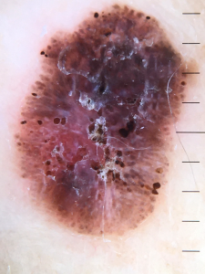 case discussion