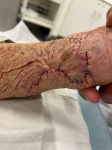 case discussion
