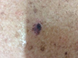 Case discussion