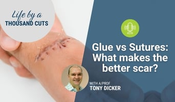 glue vs sutures