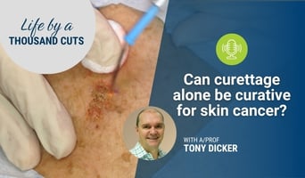 curettage for skin cancer