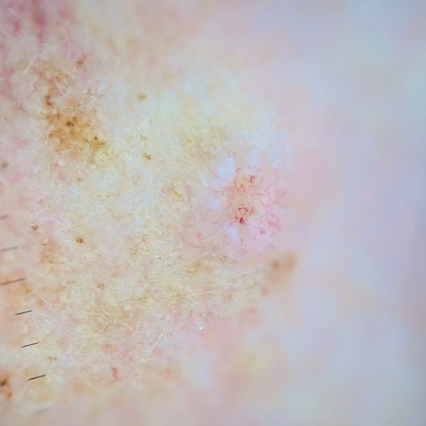 PXL_20260409_234007914.PORTRAIT~2