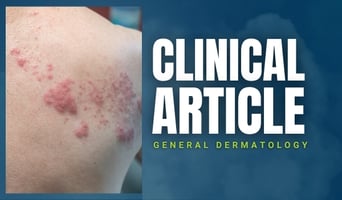 bacterial skin infections