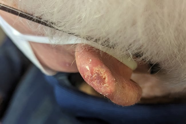 case clinical