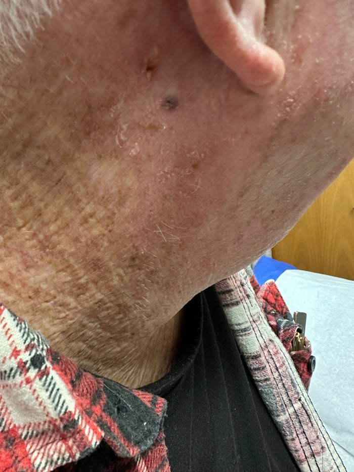 clinical image