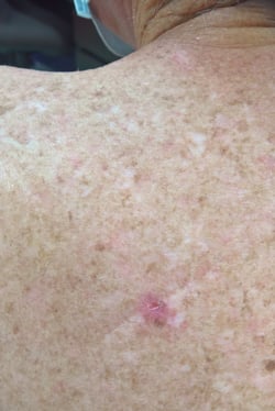 clinical-Feb-20-2024-05-39-29-8885-AM