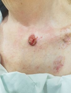clinical-image-24 April 2023 -1