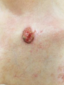 clinical-image-24 April 2023 -2