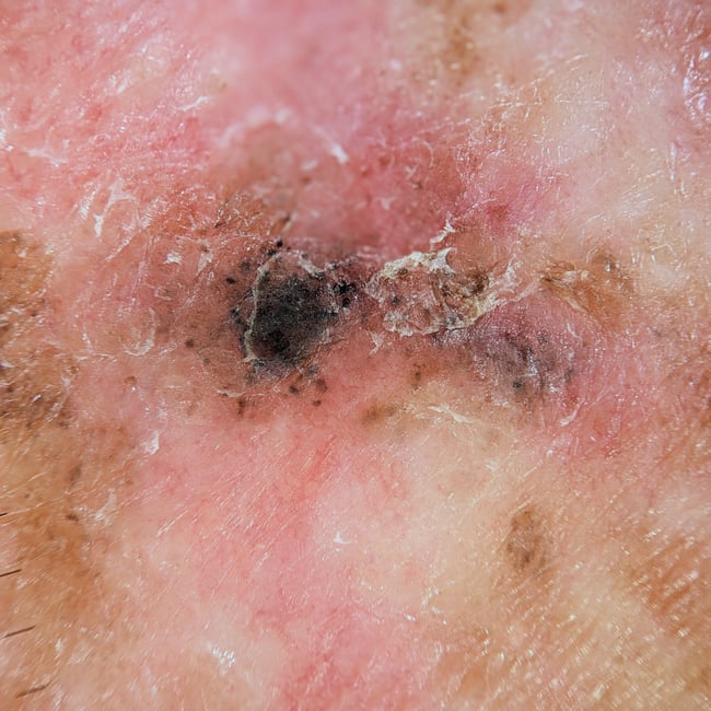 derm (1)