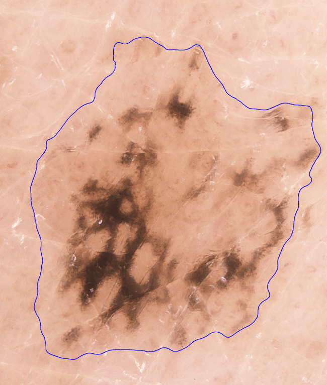 derm4