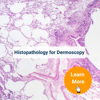histopathology_for_dermoscopy