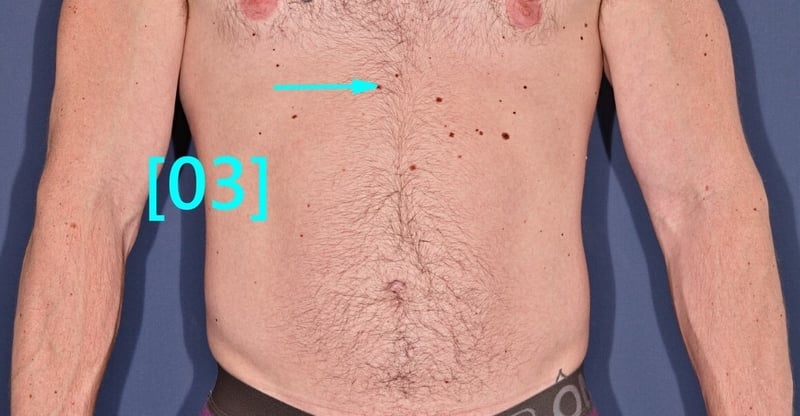 lesion 3 (1)