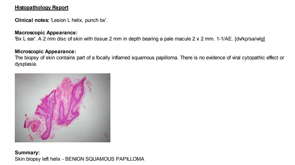 pathology-report-ear-lesion-22-May-2023
