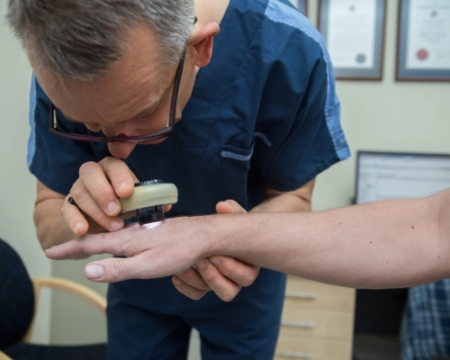 Doctor using a dermatoscope to check a lesion on a patient's arm
