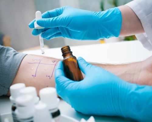 Doctor performing a patch test