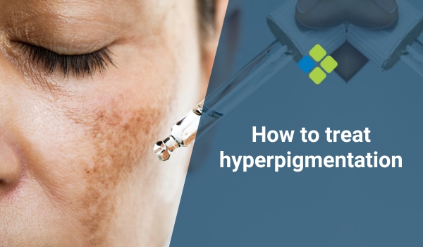 treat hyperpigmentation