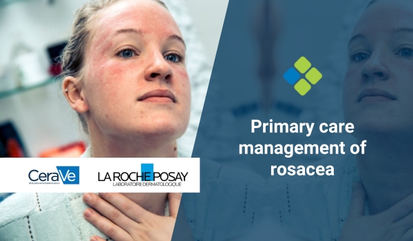 rosacea