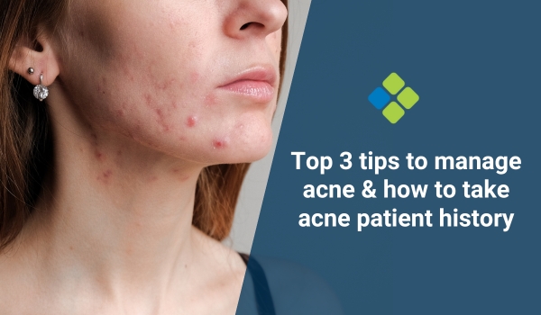 tips to manage acne