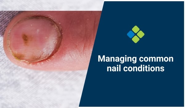 nail conditions