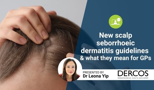 scalp seborrhoeic dermatitis