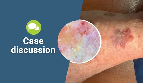 case discussion