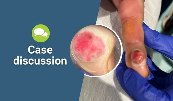 case discussion