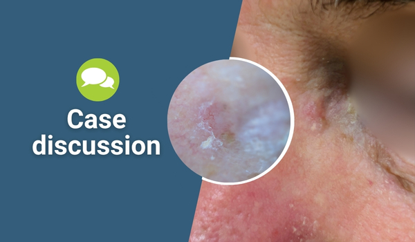 case discussion
