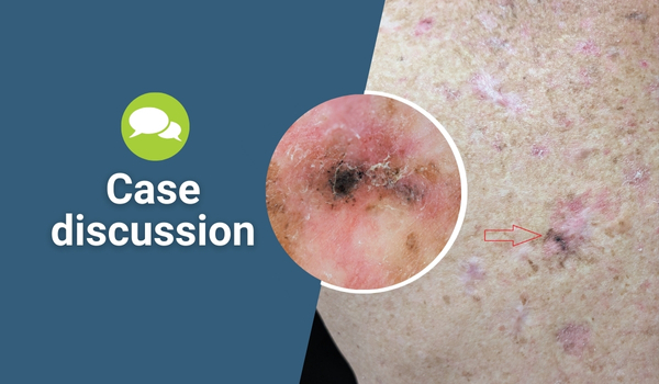 case discussion