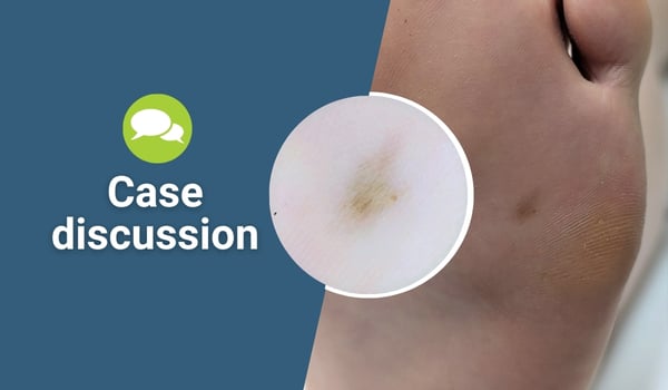 case discussion