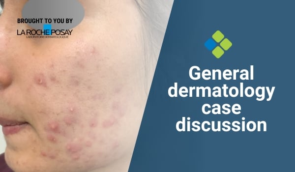 dermatology case discussion