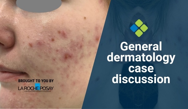 dermatology case discussion