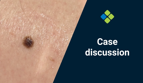 case discussion