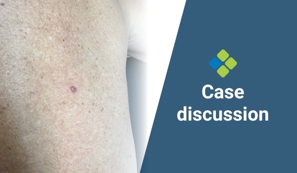 case discussion