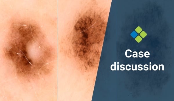 case discussion