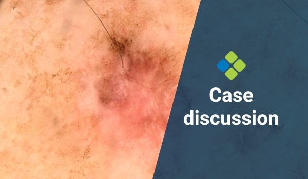 case discussion