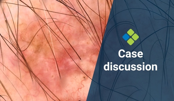 case discussion