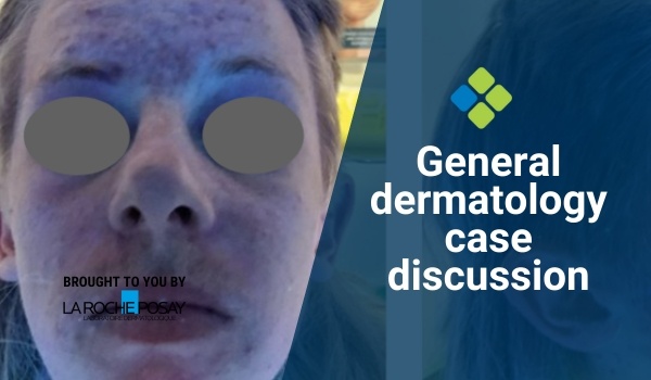case discussion