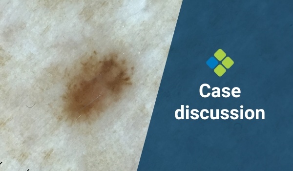 case discussion