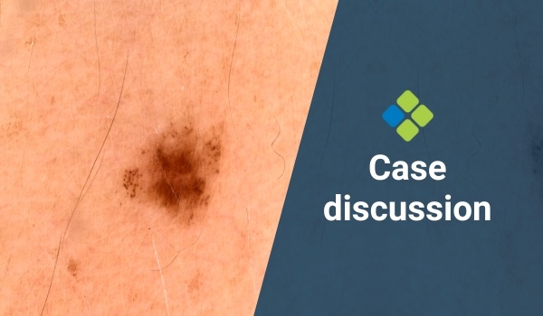 case discussion