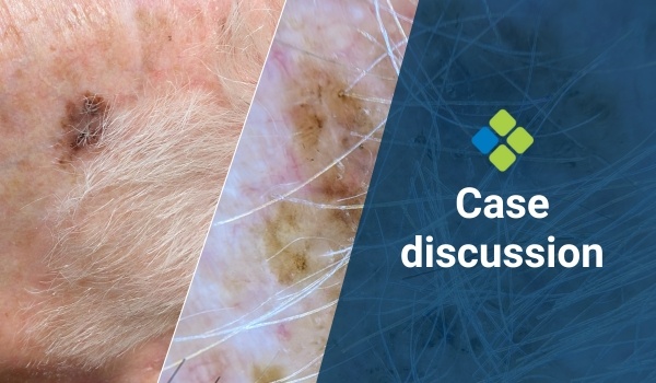 case discussion