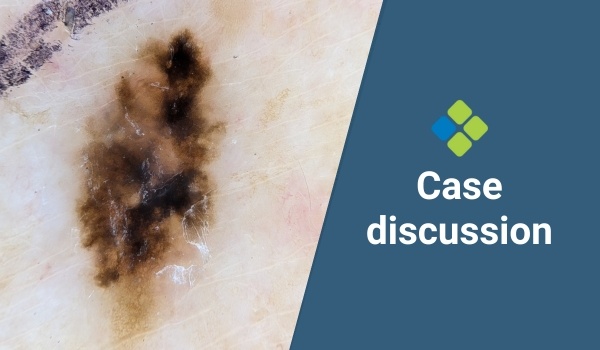 case discussion