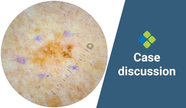 case discussion