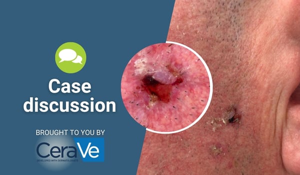 case discussion
