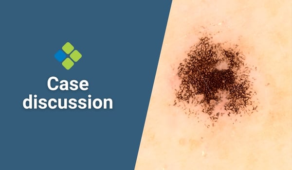 case discussion
