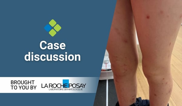 case discussion