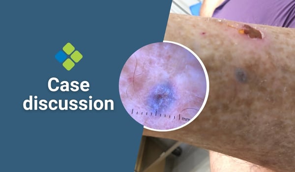 case discussion